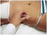 Carboxiterapia